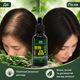 Сироватка проти випадіння для зміцнення волосся YAOPIN Plant Anti Stripping Hair Dew Стимуляція росту волосся, 30 мл - зображення 8