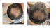 Лосьйон Kirkland для росту волосся Minoxidil 5% (6 шт. по 60 мл) - зображення 2