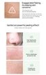 Гель-пілінг Esthetic House для обличчя з кислотами Toxheal Daily Clear Gommage Peeling Gel 200 мл - зображення 3