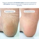 Щоденний відновлювальний крем для шкіри п'ят HeelFix DRY HEELS Daily Repair Cream ТМ «HeelFix», 100 мл HF-02-199 - зображення 2