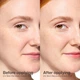 Солнцезащитный крем для лица EltaMD UV Skin Recovery Green Tint SPF 50 с цинком для чувствительной кожи 50 мл (0902) - изображение 2