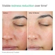 Солнцезащитный крем для лица EltaMD UV Skin Recovery Green Tint SPF 50 с цинком для чувствительной кожи 50 мл (0902) - изображение 3