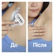 Станок для гоління жіночий (бритва) Gillette Venus Extra Smooth Sensitive RoseGold з 3 змінними картриджами - изображение 6