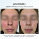 AG Skin Зволожуючий крем SPF 50+ MOISTURISING CREAM SPF 50+ - зображення 2