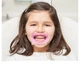 OptraGate Junior роторозширювач (ОптраГейт Юніор) Ivoclar, 1шт (упак. 40 шт) (9610-1611) - зображення 2