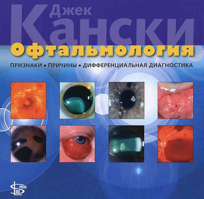 

Офтальмология. Признаки, причины, дифференциальная диагностика