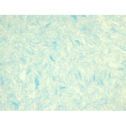 

Жидкие обои Limil № 374 бело-голубые