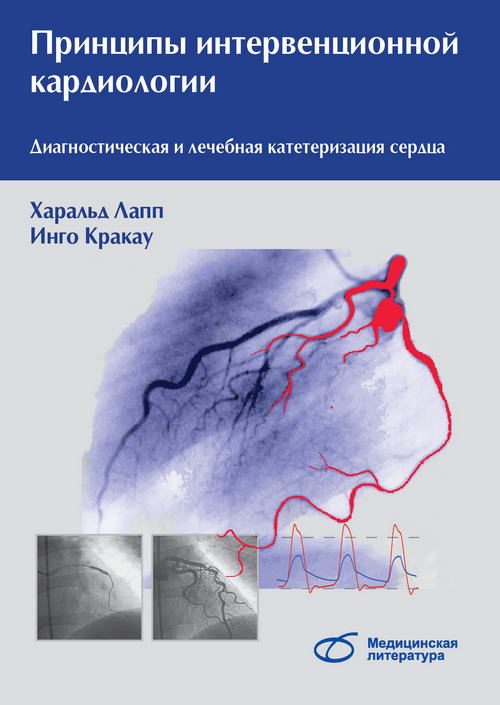 

Принципы интервенционной кардиологии