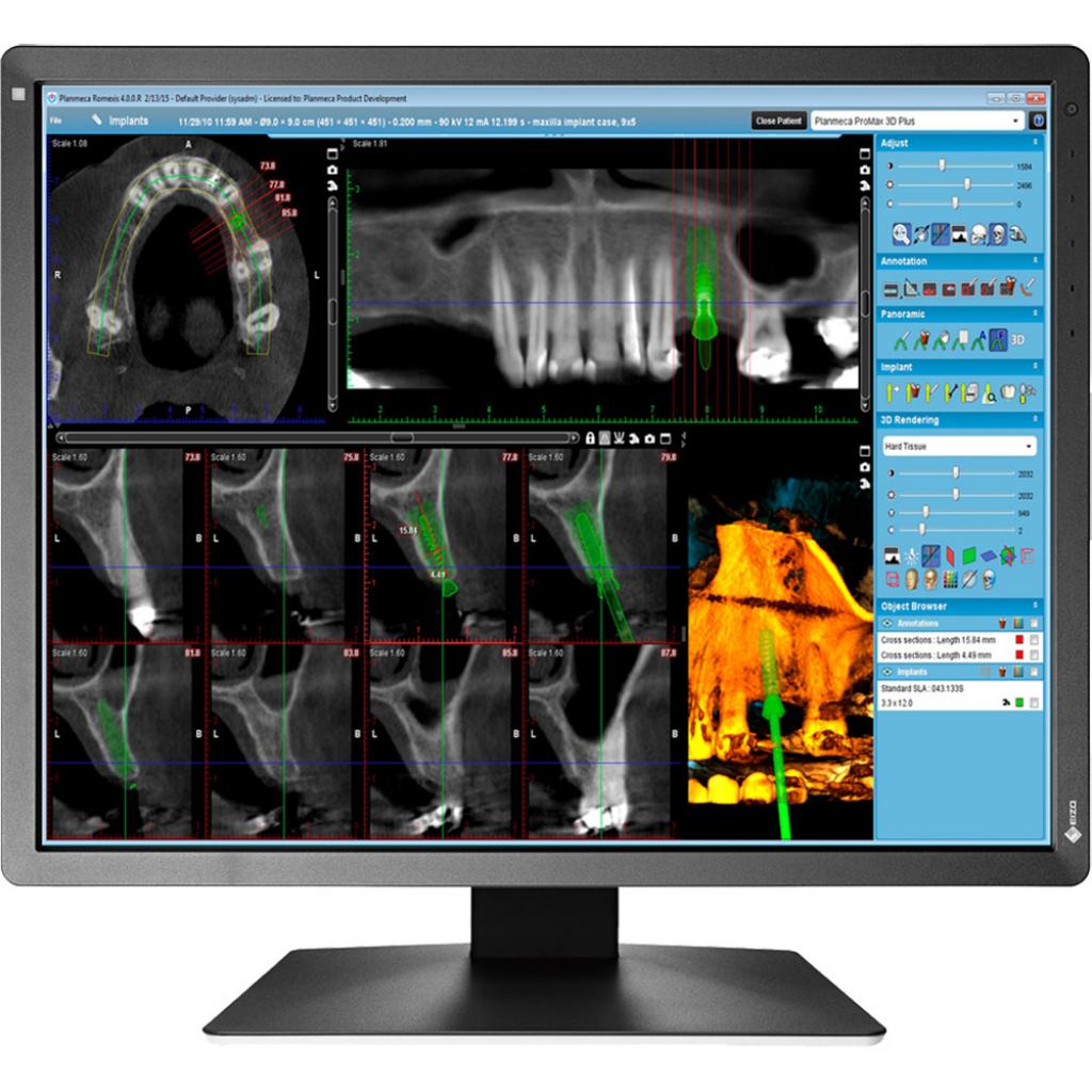

Монитор EIZO MX216-SB