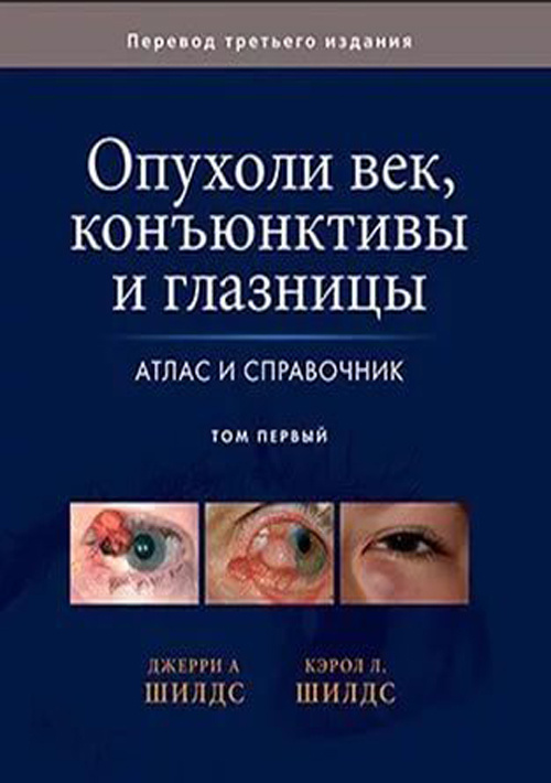 

Опухоли век, конъюктивы и глазницы. Атлас и справочник. Том 1 - Джерри А. Шилдс, Кэрол Л. Шилдс (978-5-91839-082-5)