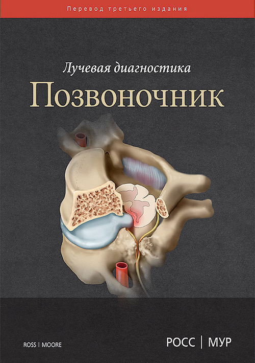 

Лучевая диагностика. Позвоночник - Росс Дж.С. (978-5-91839-096-2)