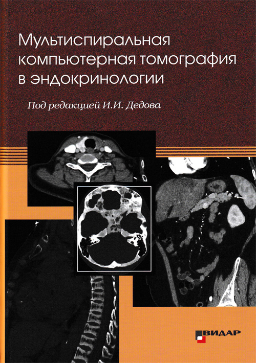 

Мультиспиральная компьютерная томография в эндокринологии - под ред. И.И. Дедова (978-5-88429-258-1)