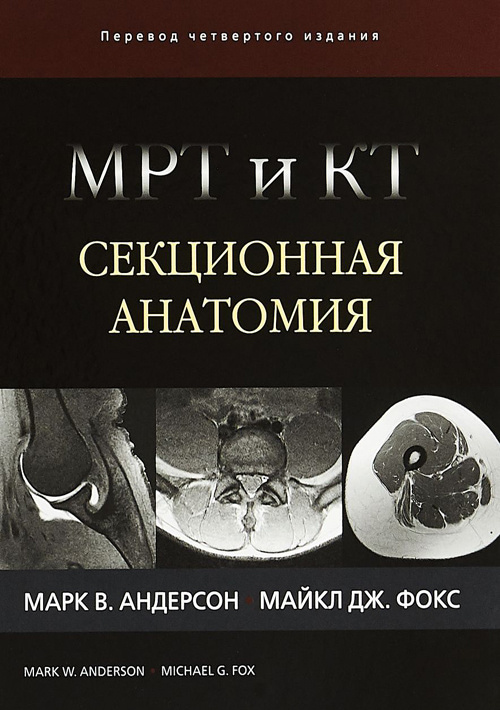 МРТ и КТ. Секционная анатомия - Андерсон Марк В., Фо Майкл Дж. (978-5-91839-100-6)