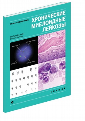 

Хронические миелоидные лейкозы. Атлас-справочник - Б. Дж. Бейн, Э. Матутес (978-5-906456-04-5)