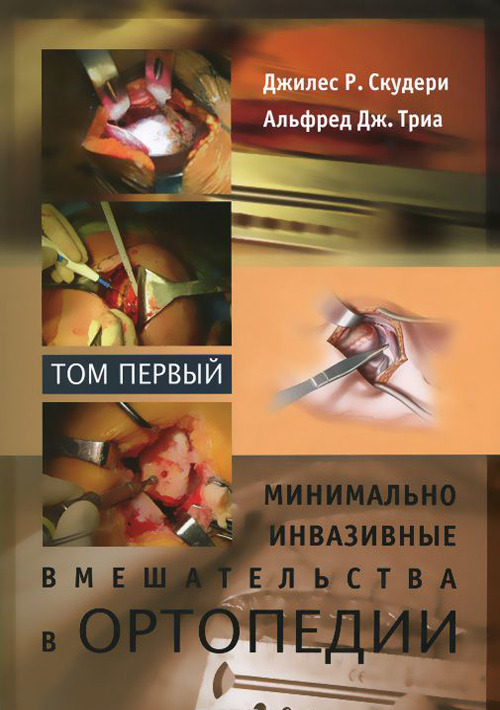 

Минимально инвазивные вмешательства в ортопедии: в 2-х томах. Том 1 - Джилес Р. Скудери (978-5-91839-046-7)