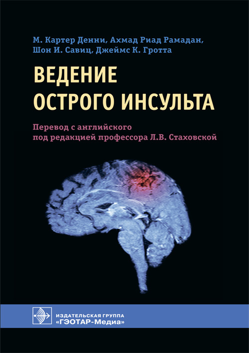 

Ведение острого инсульта - Денни М.К. и др. (978-5-9704-5902-7)