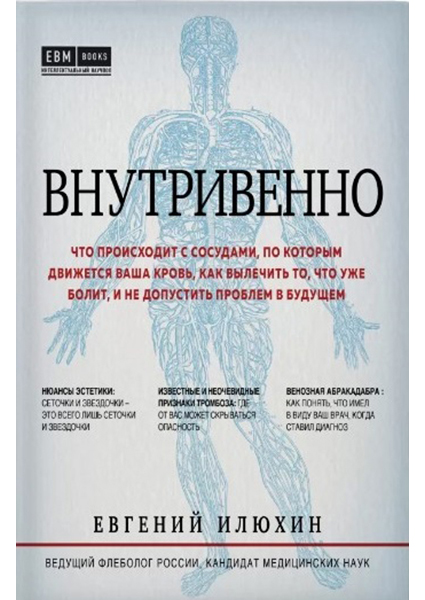 

Внутривенно. Что происходит с сосудами, по которым движется ваша кровь, как вылечить то, что уже болит, и не допустить проблем в будущем 88919