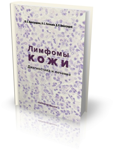 

Лимфомы кожи: диагностика и лечение