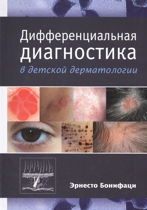 

Дифференциальная диагностика в детской дерматологии (880526)