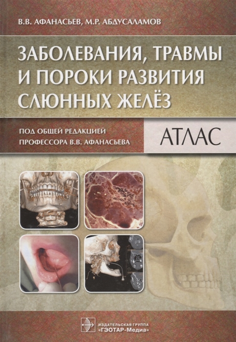 

Заболевания, травмы и пороки развития слюнных желёз. Атлас