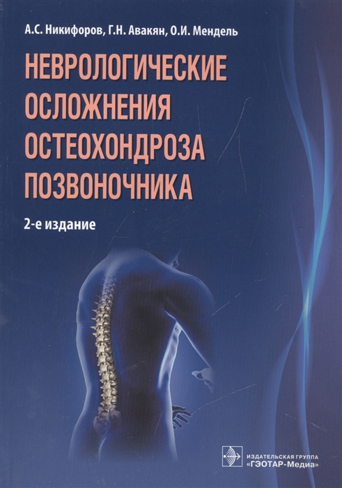 

Неврологические осложнения остеохондроза позвоночника (1141410)