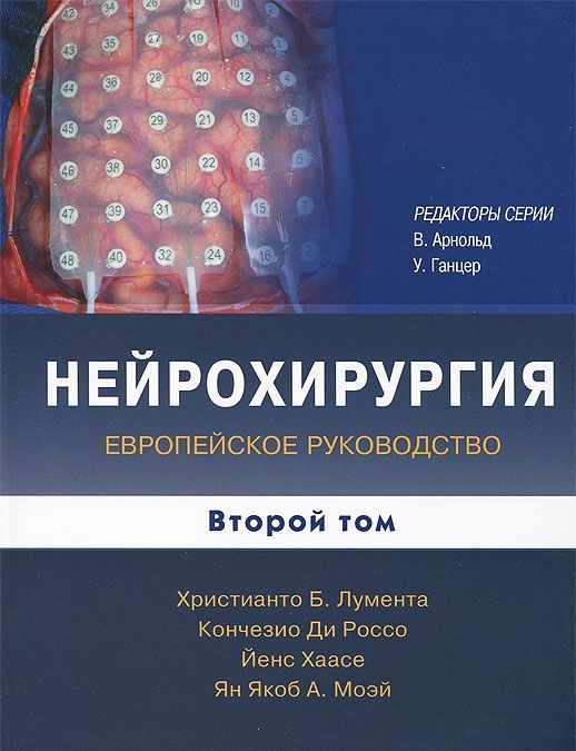 

Нейрохирургия. Европейское руководство. В 2-х томах. Том 2 (691446)