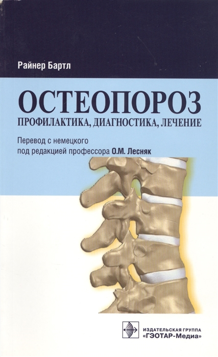 

Остеопороз. Профилактика, диагностика, лечение (536868)