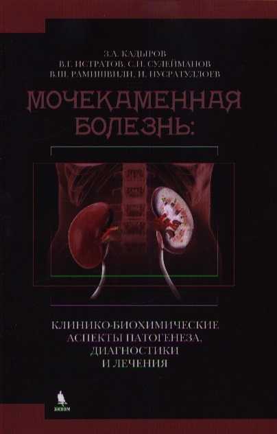 

Мочекаменная болезнь. Клинико-биохимические аспекты патогенеза, диагностики и лечения