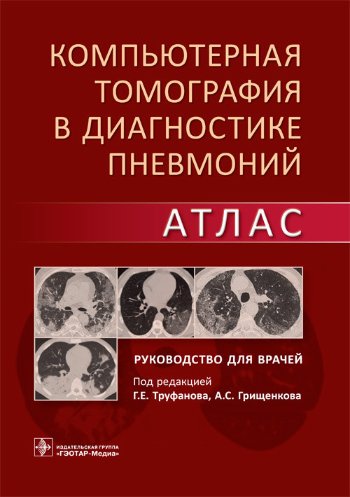 

Компьютерная томография в диагностике пневмоний. Атлас. Руководство для врачей