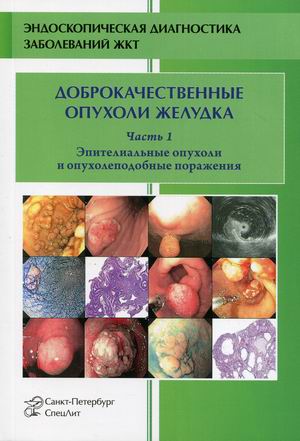 

Доброкачественные опухоли желудка. Часть 1: Эпителиальные опухоли и опухолеподобные поражения. Учебно-методическое пособие