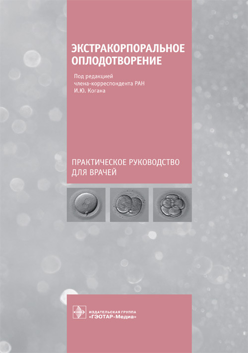 

Экстракорпоральное оплодотворение (4300089)
