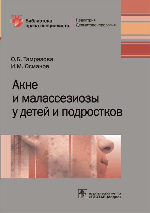 

Акне и малассезиозы у детей и подростков (4249204)