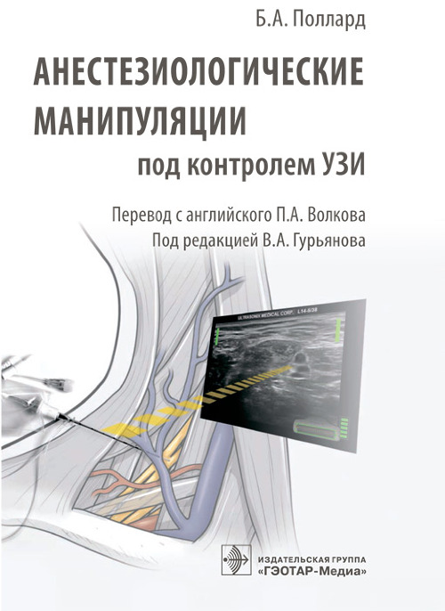 

Анестезиологические манипуляции под контролем УЗИ (4294748)