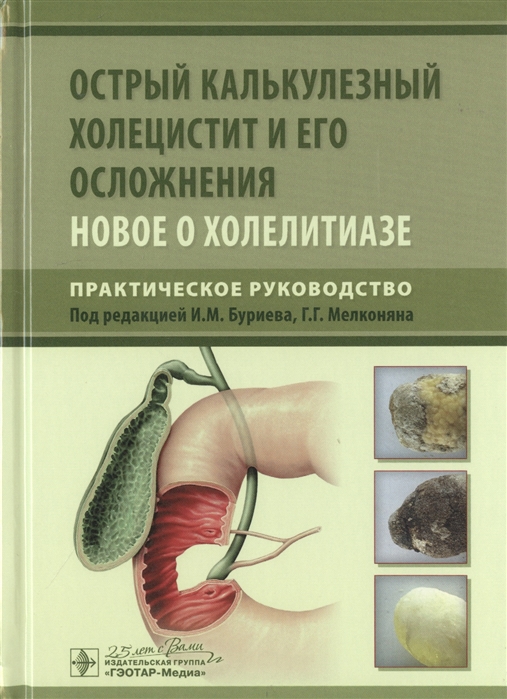 

Острый калькулезный холецистит и его осложнения. Новое о холелитиазе