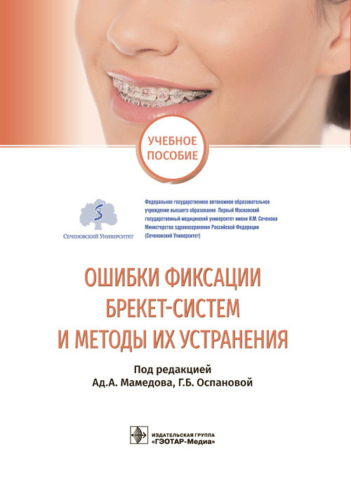 

Ошибки фиксации брекет-систем и методы их устранения