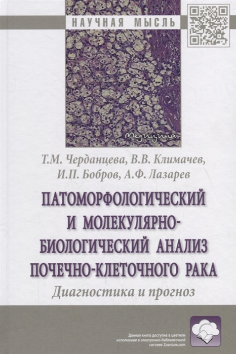 

Патоморфологический и молекулярно-биологический анализ почечно-клеточного рака.Диагностика и прогноз