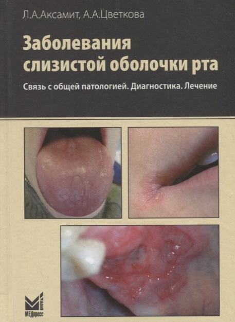 

Заболевания слизистой оболочки рта. Связь с общей патологией. Диагностика. Лечение (4155815)