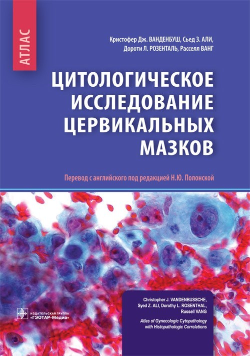

Атлас. Цитологическое исследование цервикальных мазков - Ванденбуш К.Дж. 2018 г. (978-5-9704-4543-3)