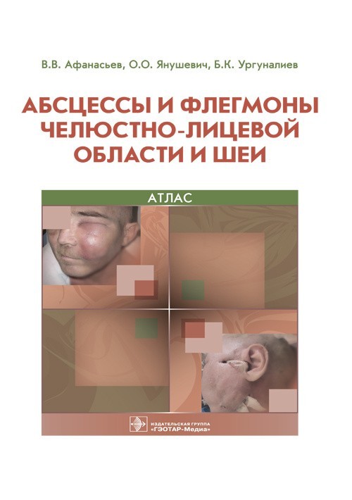 

Атлас. Абсцессы и флегмоны челюстно-лицевой области и шеи - Афанасьев В.В., Янушевич О.О., Ургуналиев Б.К. 2019 г. (978-5-9704-4803-8)