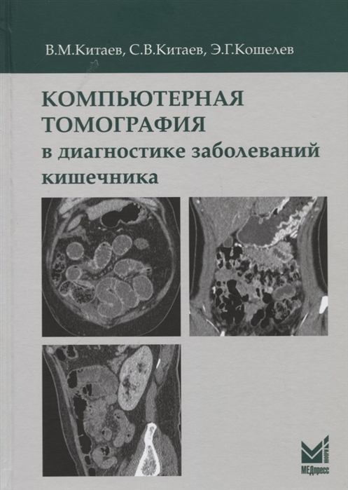 

Компьютерная томография в диагностике заболеваний кишечника