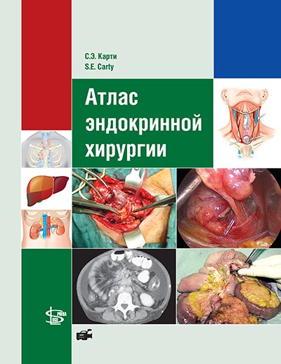 

Атлас эндокринной хирургии