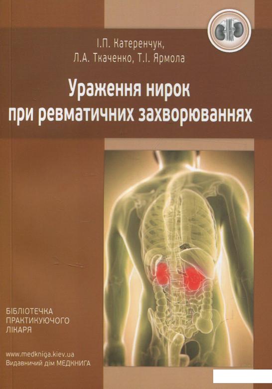 

Ураження нирок при ревматичних захворюваннях (847824)