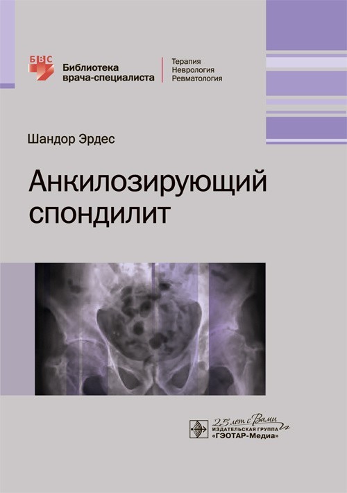 

Библиотека врача-специалиста. Анкилозирующий спондилит - Эрдес Ш. 2020 г. (978-5-9704-5732-0)