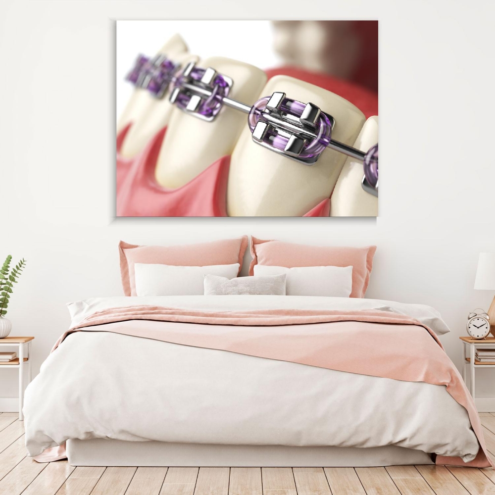 

Картина на холсте Стоматология Teeth With Purple Braces 110х150 см.