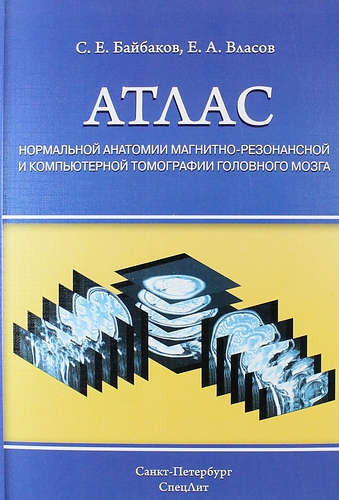 

Байбаков С.Е. Атлас нормальной анатомии магнитно-резонансной и компьютерной томографии головного мозга (978-5-299-00494-6) Изд. СпецЛит