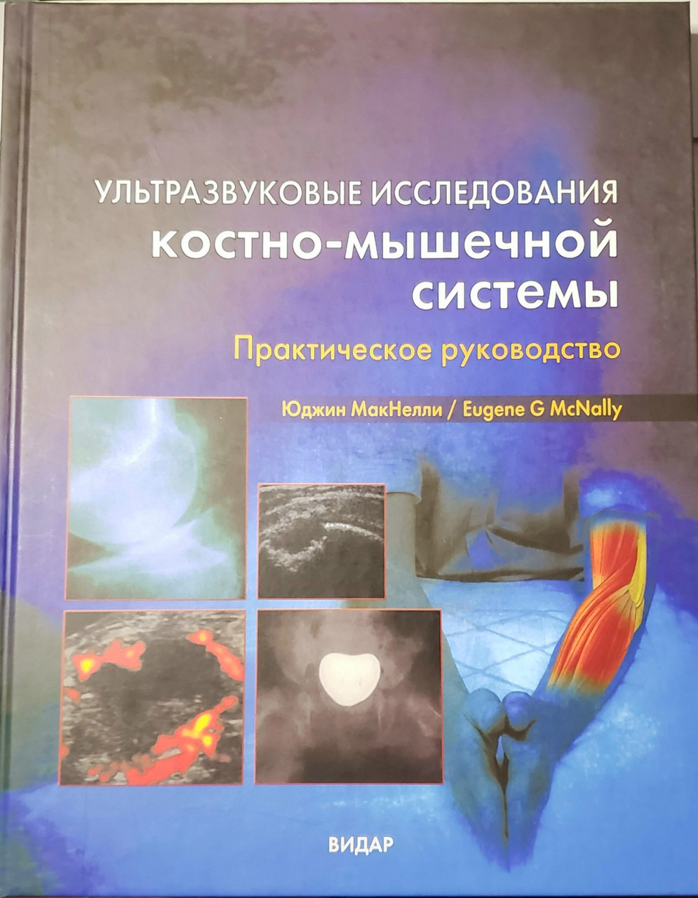 

Юджин Мак Нелли Ультразвуковая диагностика костно-мышечной системы (978-5-88429-097-6) Изд. Видар-М