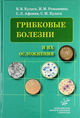 

Кулага В.В., Романенко И.М., Афонин С.Л., Кулага С.М. Грибковые болезни и их осложнения (978-5-8948-1849-8) Изд. Медицинское информационное агентство