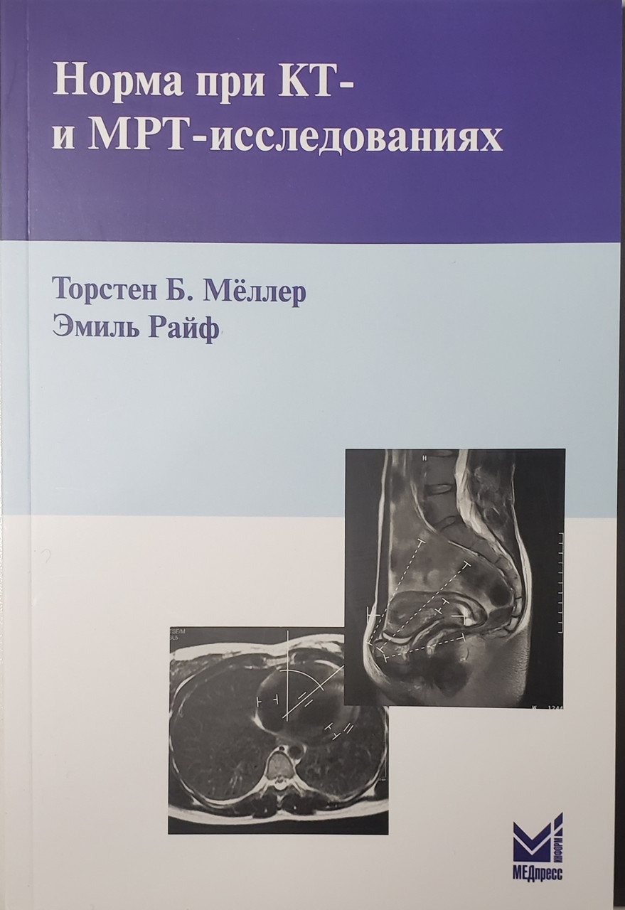 

Торстен Б. Меллер, Эмиль Райф Норма при КТ- и МРТ-исследованиях 2020 год (978-5-00030-793-9) Изд. МЕДпресс-информ
