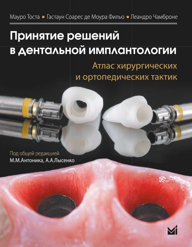 

Тоста МауроПринятие Решений в дентальной имплантологии атлас хирургических и ортопедических тактик 2020 год (978-5-00030-796-0) Изд. МЕДпресс-информ
