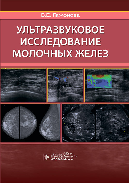 

Ультразвуковое исследование молочных желез / В. Е. Гажонова. 2020 год (978-5-9704-5422-0) Изд. ГЭОТАР-Медиа